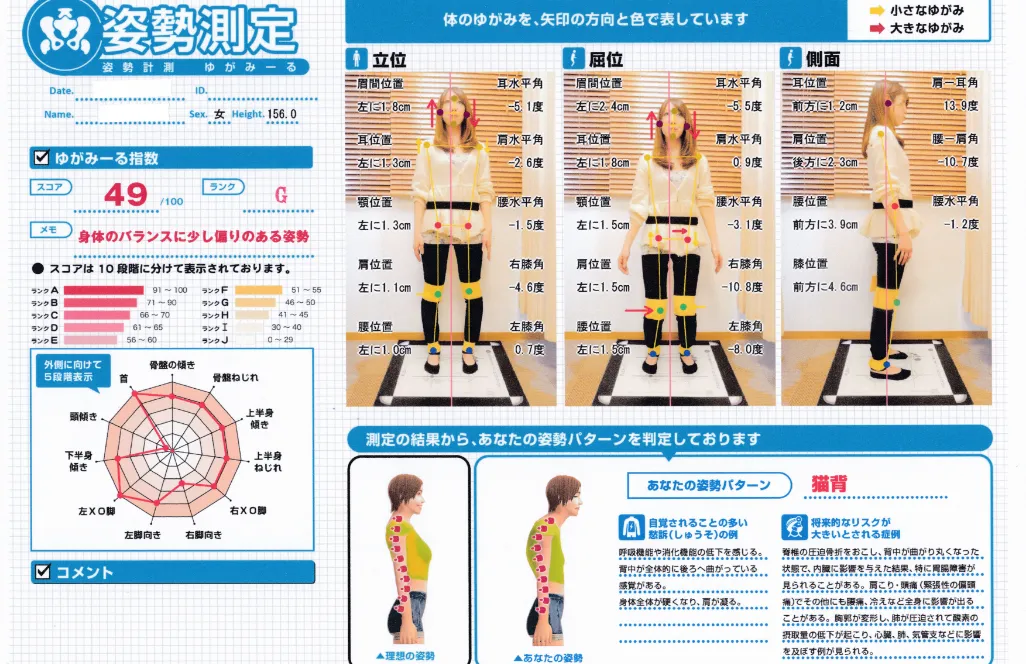 姿勢測定のための図解
